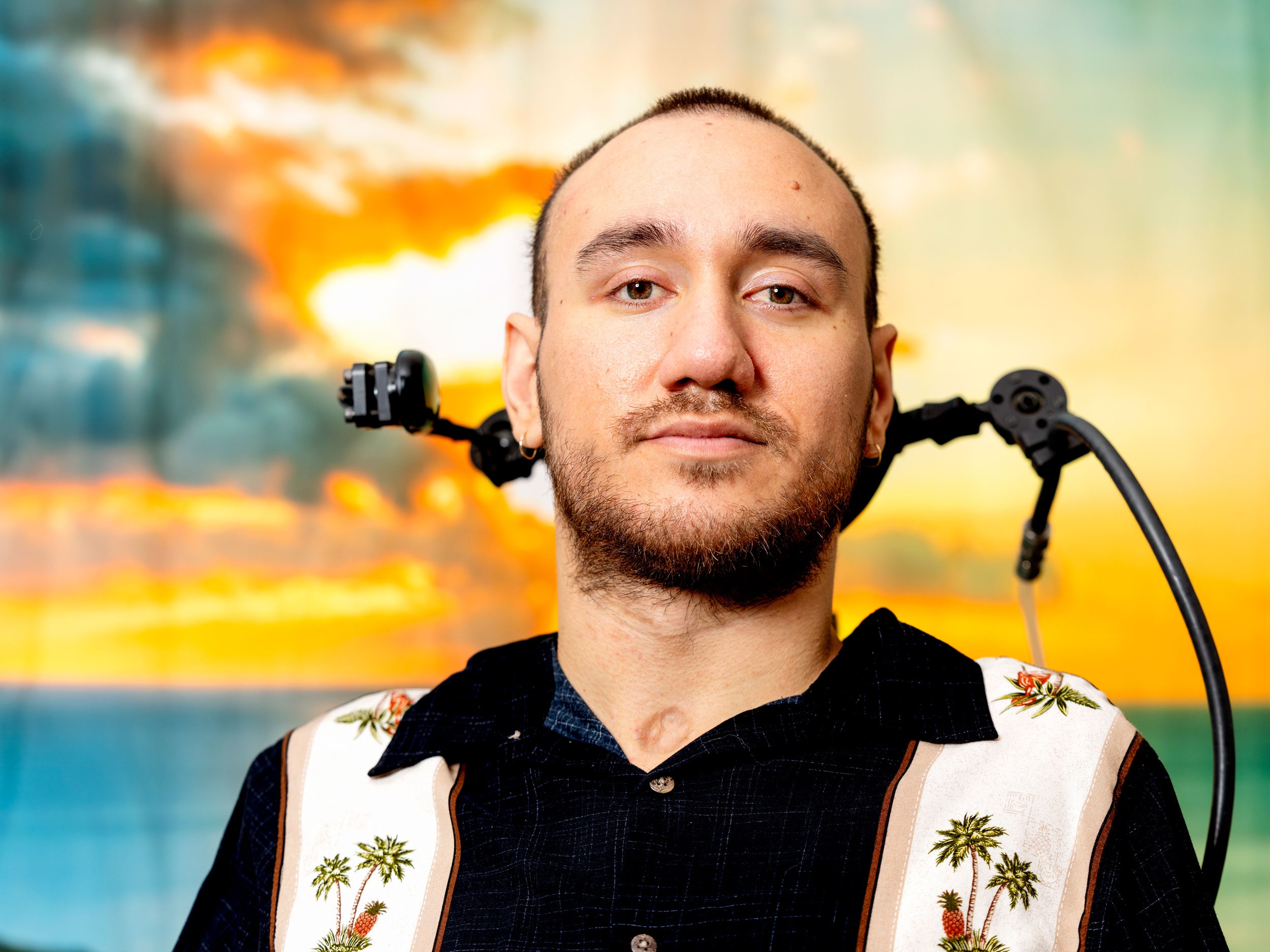 Primer usuario de Brain Implant Neuralink
